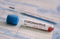 С 19 января въезд  Болгарию только с отрицательным тестом на коронавирус